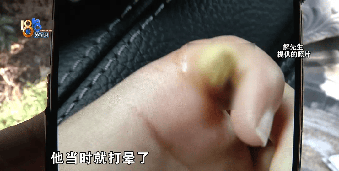 5歲男童瞬間暈厥，筋都斷了！街上常見，看見立即遠離