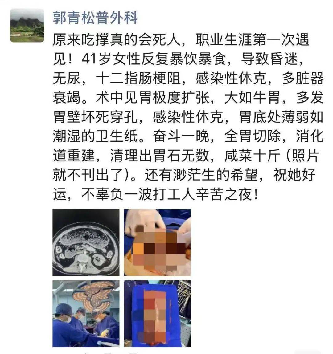 女子多器官衰竭、整個胃被摘除，醫生清理出10斤……緊急提醒