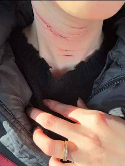 前男友公開金賽綸自殘照，稱她的死與金秀賢無關